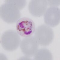 An open angular parasite, note pigment