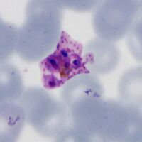 Small mature form with separated merozoites