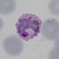 Large thickened ring trophozoite