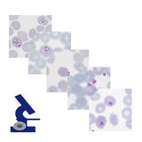 Galleries of parasite appearance