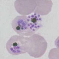 Variable merozoite number, clumped pigment