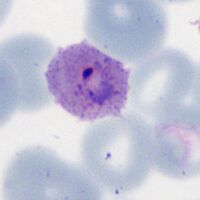 Ring early ovoid change