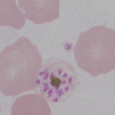 Gallery of schizonts - MalariaETC