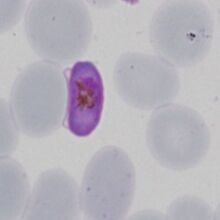 P.falciparum microgametocyte