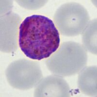 Large macrogametocyte fills red cell