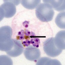 Rupturing schizont of P.malariae