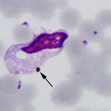Thin film: neutrophil pigment