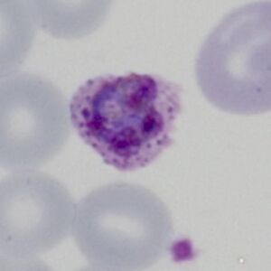 Gallery of schizonts - MalariaETC