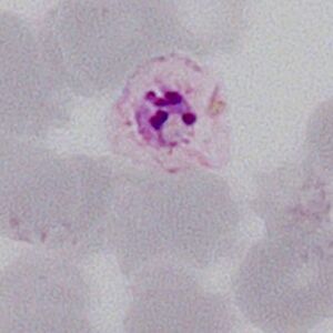 Gallery of schizonts - MalariaETC