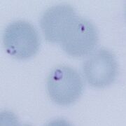 Single fine early rings similar to malaria