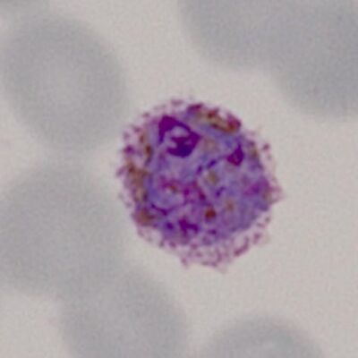 Gallery of schizonts - MalariaETC