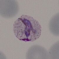 Early ring form with faint dots