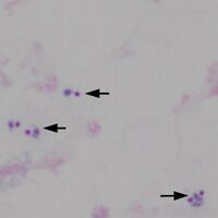 Region B: 5 trophozoites in three group