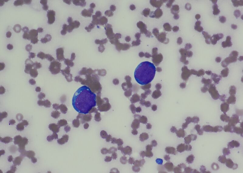 File:Possible primitive cells PR.jpg