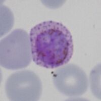 Round parasite note the pigment around the circumference