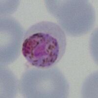 A neat round, possible macrogametocyte form