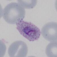 Solid parasite, red cell fimbriation ("comet form")