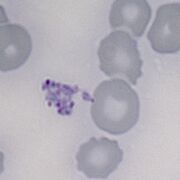 A group of parasites appearing as a mass outside of erythrocytes