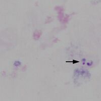 Region C: 2 trophozoites in one group