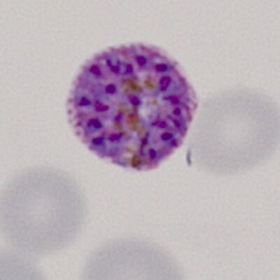 Gallery of schizonts - MalariaETC