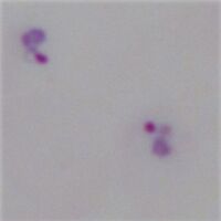 High-power image of the parasites