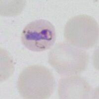 Early elongated form, small red cell