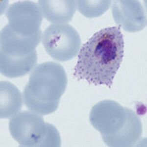 Gallery of late trophozoites - MalariaETC